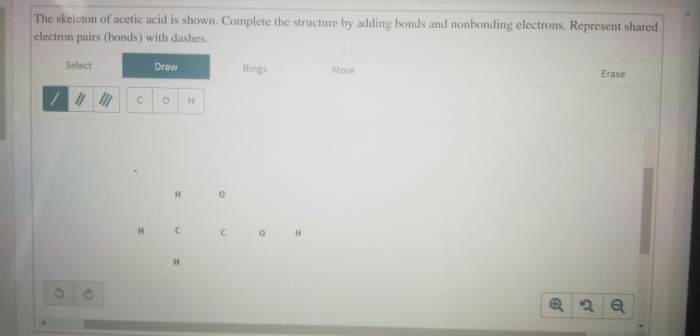 Complete the structure by adding bonds and nonbonding electrons.